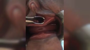 字母圈网红SM界天花板重度性虐大师Imur各种极限调教私拍扩张 异物 虐阴虐尿道花样繁多(31)